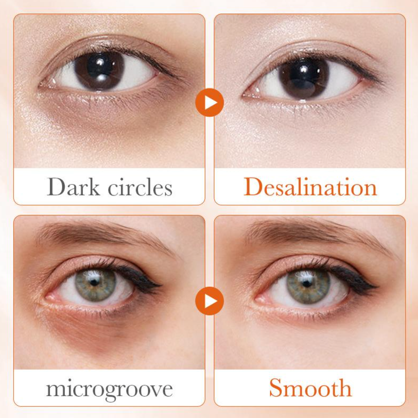 SADOER 5 in 1 Vitamin C Eye Cream Anti Dark Circles